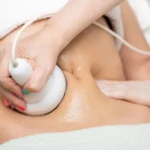 Lipoma Removal in London: Best Clinics & Cost Guide