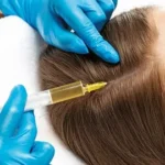 PRP in Novi: Natural Skin & Hair Rejuvenation | Skinfluence Aesthetics