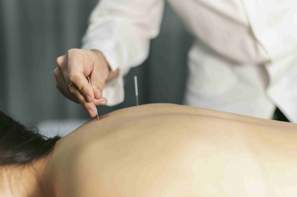 Can Acupuncture Improve Fertility and Reproductive Health?