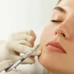 Botox Treatment in Plano, Texas: Reclaim Your Youthful Glow