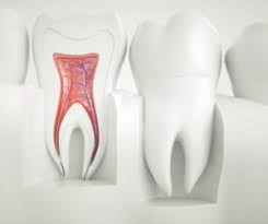 How to Know if You Need a Root Canal and What to Expect