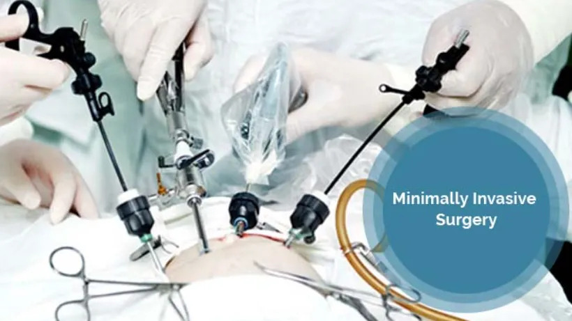Minimally Invasive Surgical Instruments Market 