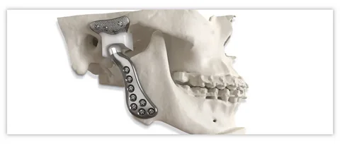 tmj specialist
