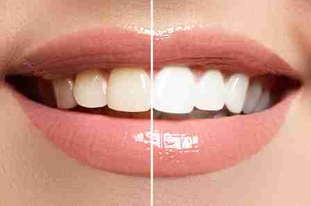 Image Source -Directory dental Liverpool