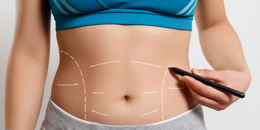 Achieve a Toned Abdomen with Abdominoplasty in Jeddah
