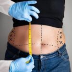 abdominoplasty surgery in islamabad