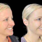 Discover Precision and Artistry with the Best Plastic Surgeons in Dubai for Botox