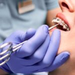 Orthodontic Dentistry in Dubai: Straighten Your Teeth the Modern Way