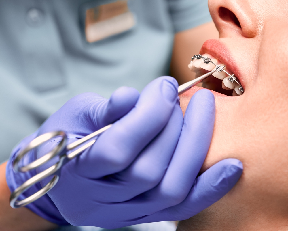 Orthodontic Dentistry in Dubai: Straighten Your Teeth the Modern Way