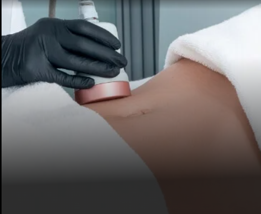 HD Liposuction in Dubai