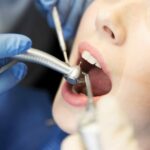 Dental implant in islamabad