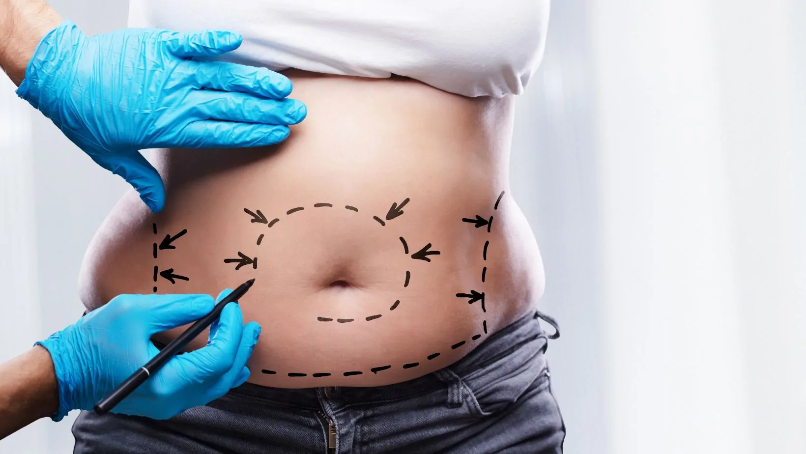 abdominoplasty in islamabad