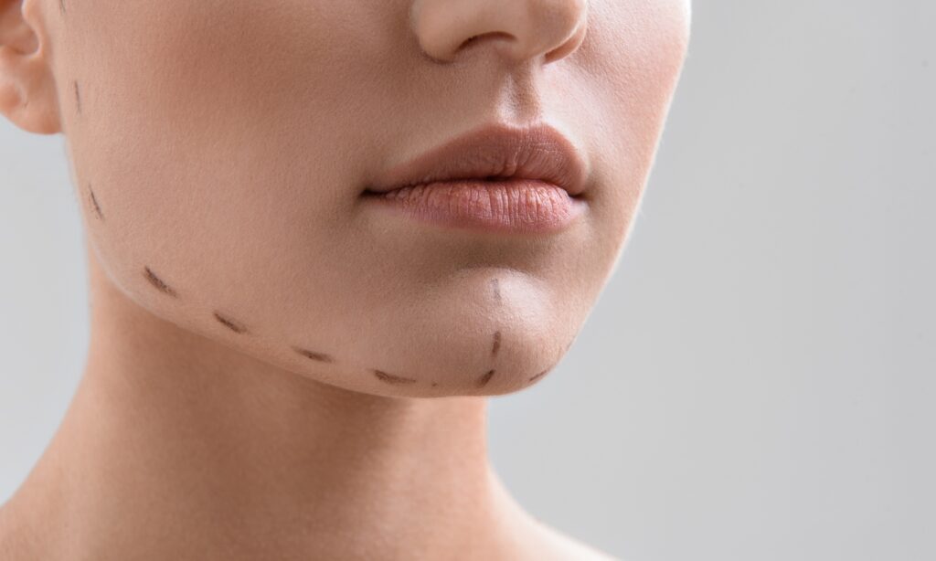jawline filler injections in islamabad