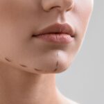 jawline filler injections in islamabad
