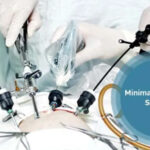 Minimally Invasive Surgical Instruments Market 