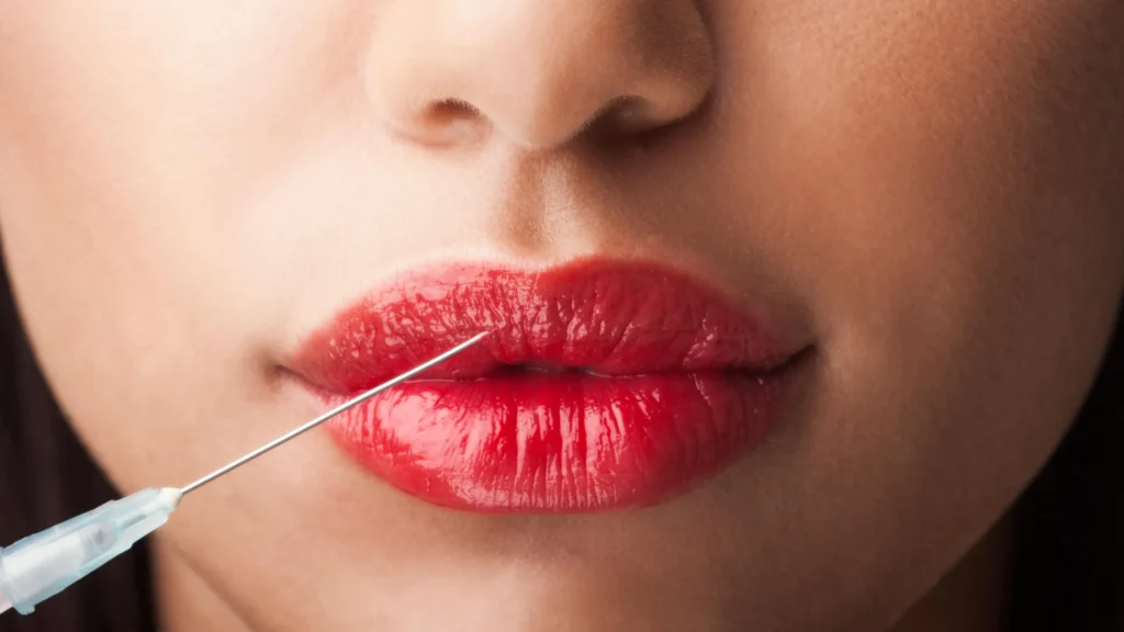lip fillers in islamabad