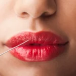 lip fillers in islamabad