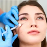 undereye fillers in islamabad